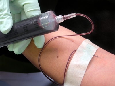 doping red blood cells Blood doping is the practice of boosting the number of red blood cells in the bloodstream in order to enhanceathletic performance because suchblood cells carry oxygen from the lungs to the. doping red blood cells Blood doping is the practice of boosting the number of red blood cells in the bloodstream in order to enhanceathletic performance because suchblood cells carry oxygen from the lungs to the.